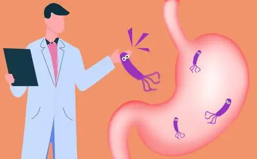 杭州御和堂老中医为你解答：这些惕早期胃癌大便的症状。