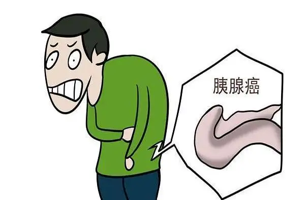 杭州如何选择好的胰腺癌医馆？