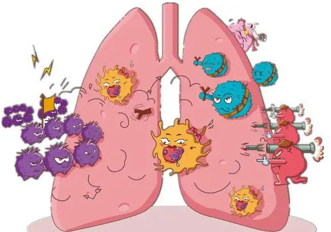 支气管肺癌与肺癌的区别