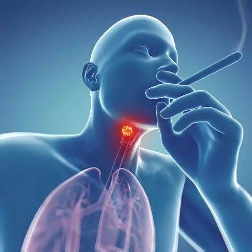 喉癌的转移方式有哪些?